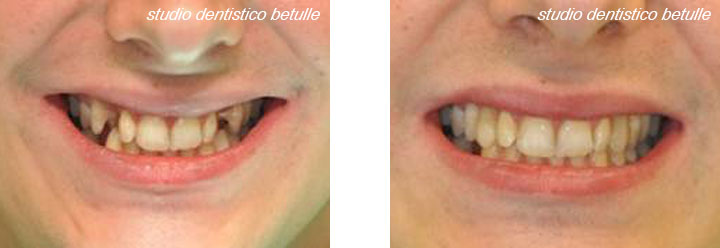 Studio dentistico Betulle - Nerviano