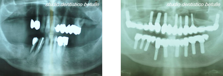 Studio dentistico Betulle - Nerviano